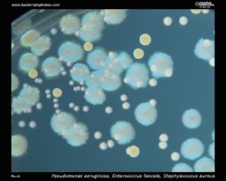 pseudomonas aeruginosa, enterococcus faecalis and staphylococcus aureus on tryptic soy agar